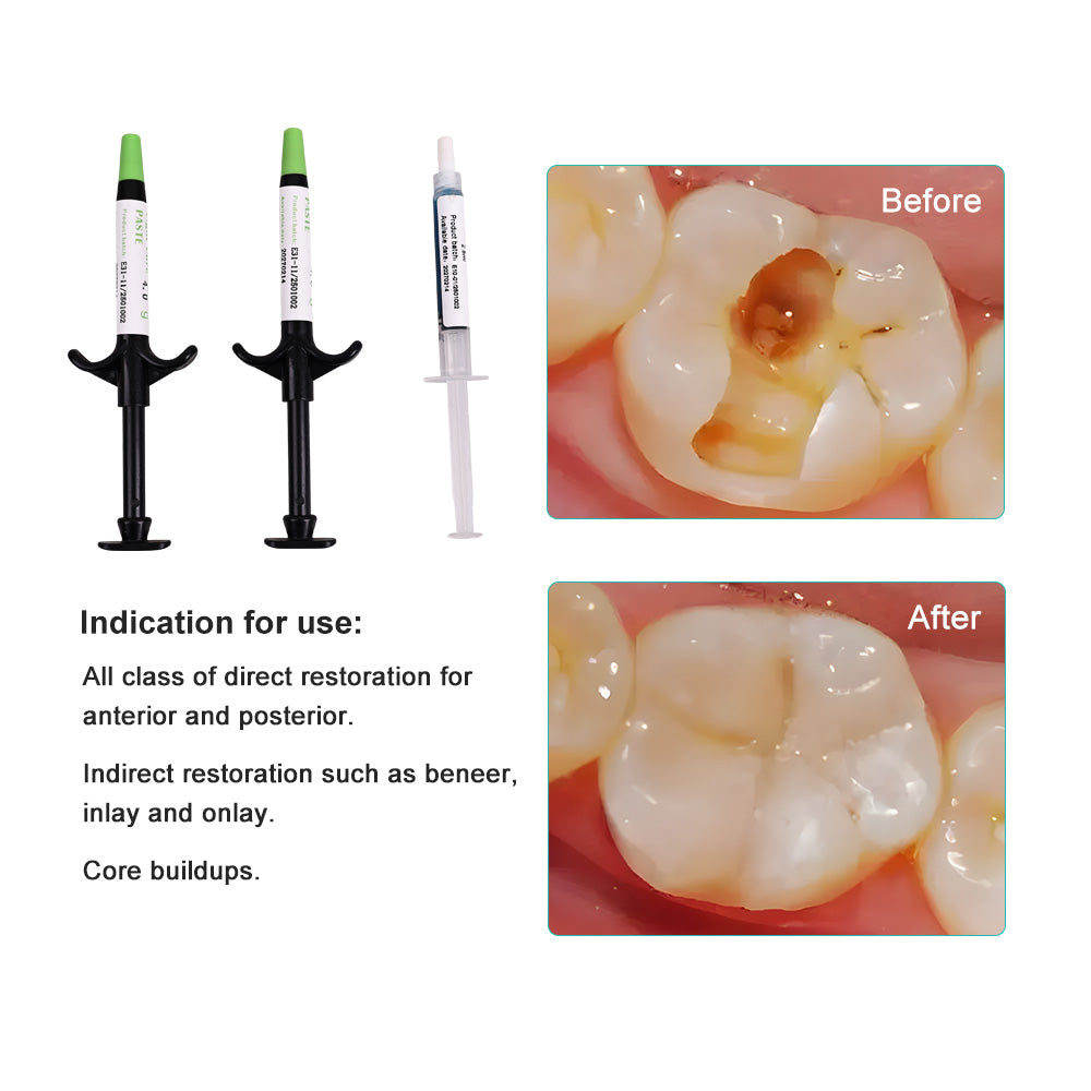 CYU159 Dental Orthodontic Adhesive Kit Green Glue
