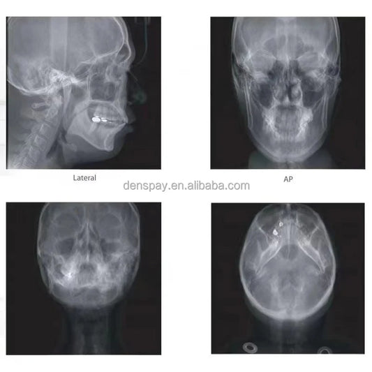 CYG108 Genoray PAPAYA Plus 3D CBCT Dental X-ray System - Denspay Dental -