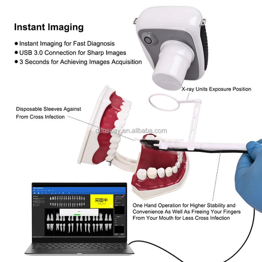 CYG078 Portable Digital Dental X Ray Machine 70kV - Denspay Dental - X-ray Machine