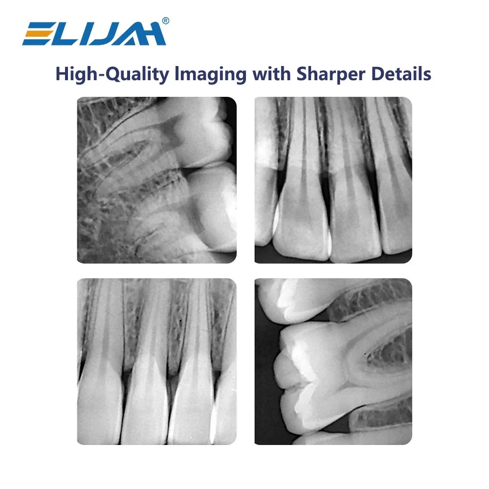 CYG113 Dental X Ray Sensor - Denspay Dental - Digital X-Ray Sensor