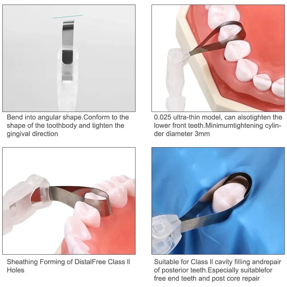 CYW741 Dental Pro Matrix Bands - Denspay Dental - Matrix Bands & Clamp