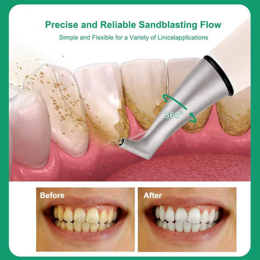 CYM025 Dental Air Polisher - Denspay Dental - Sandblasting Scaler