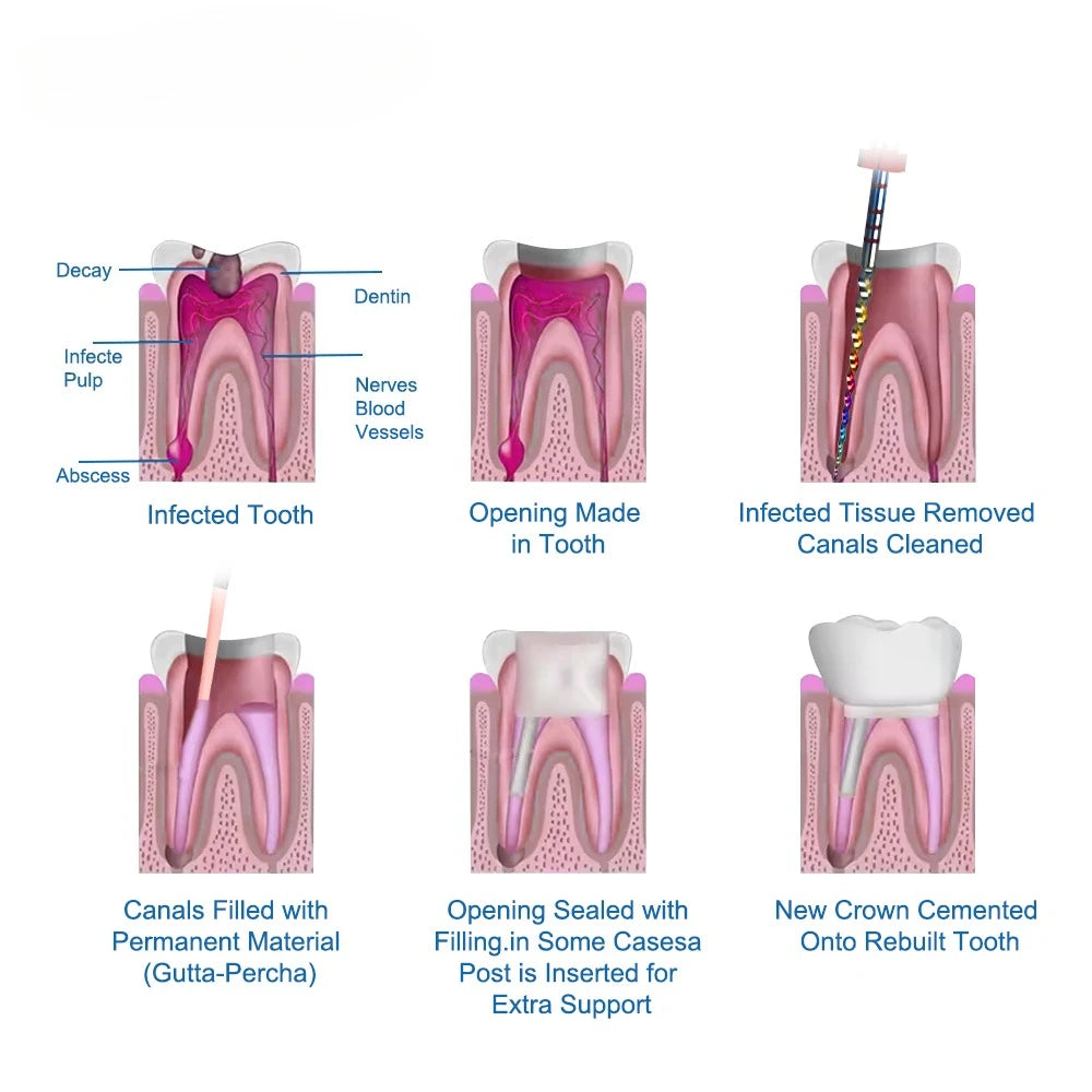 ELIJAH Dental Gutta Percha Points