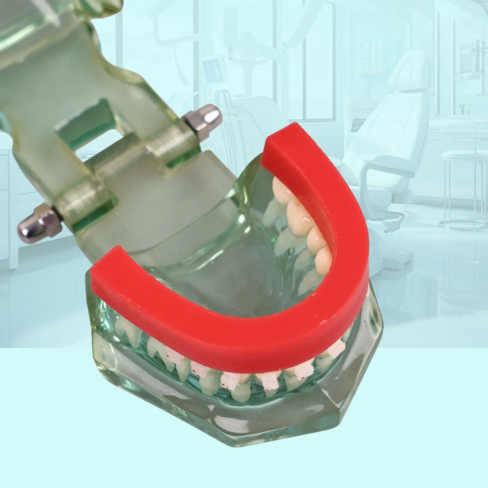 CYW842 Impression Tray (Wax Rim)