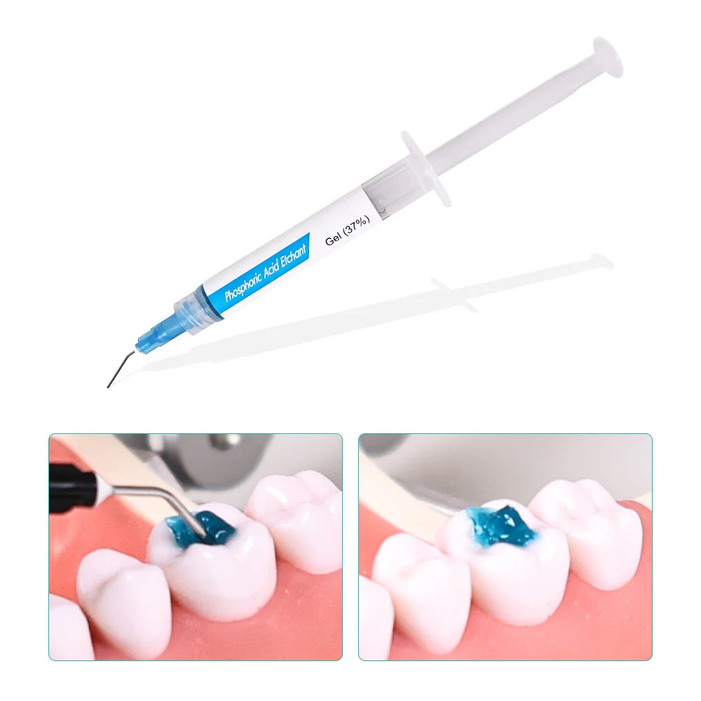 CYU157 Dental Orthodontic Adhesive Blue Glue