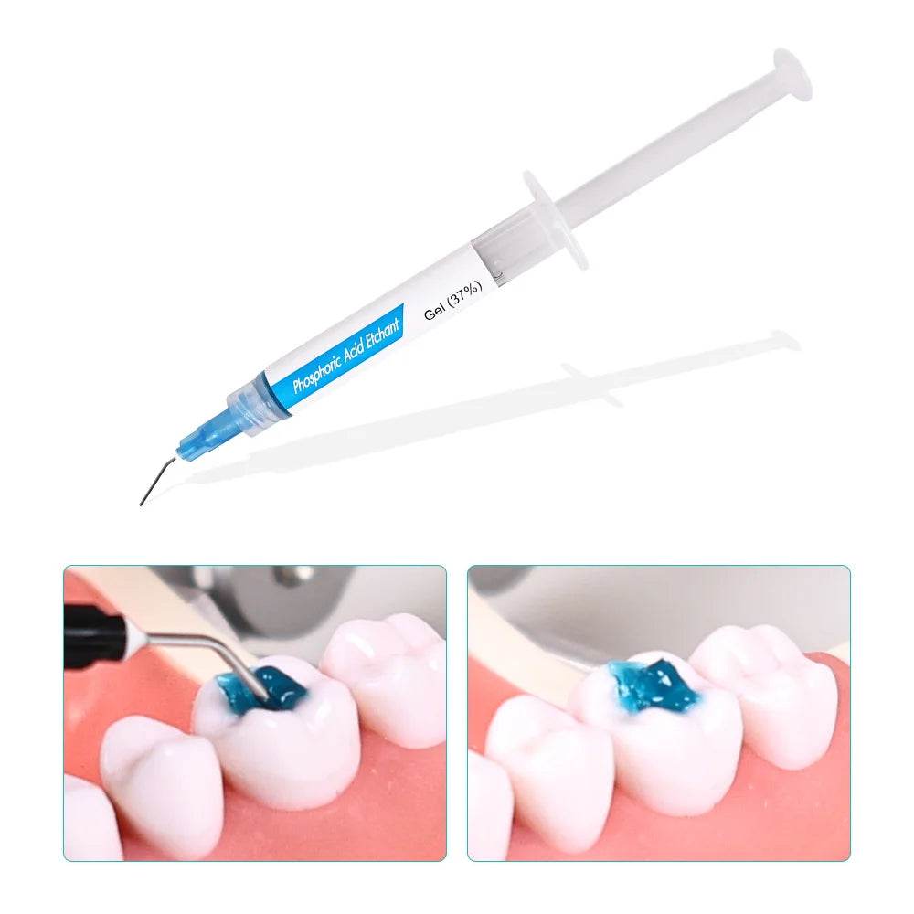 CYU157 Dental Orthodontic Adhesive Blue Glue - Denspay Dental - Composite Resin