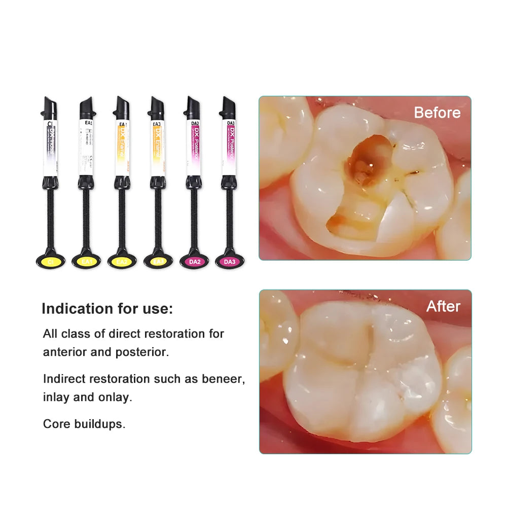CYU115 Dentex Dental Nano Hybrid Light Cure Composite Kit