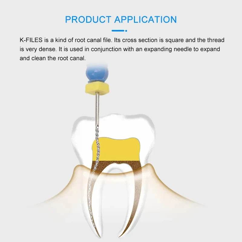 CYF322 Dental Hand Use K Files - Denspay Dental - K-Files