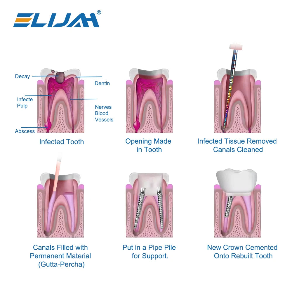 CYW837 Dental Screw Posts