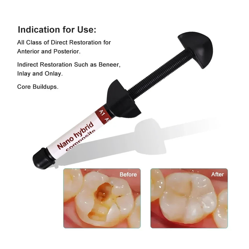 CYU204 Dental Nano Hybrid Composite Resin Kit