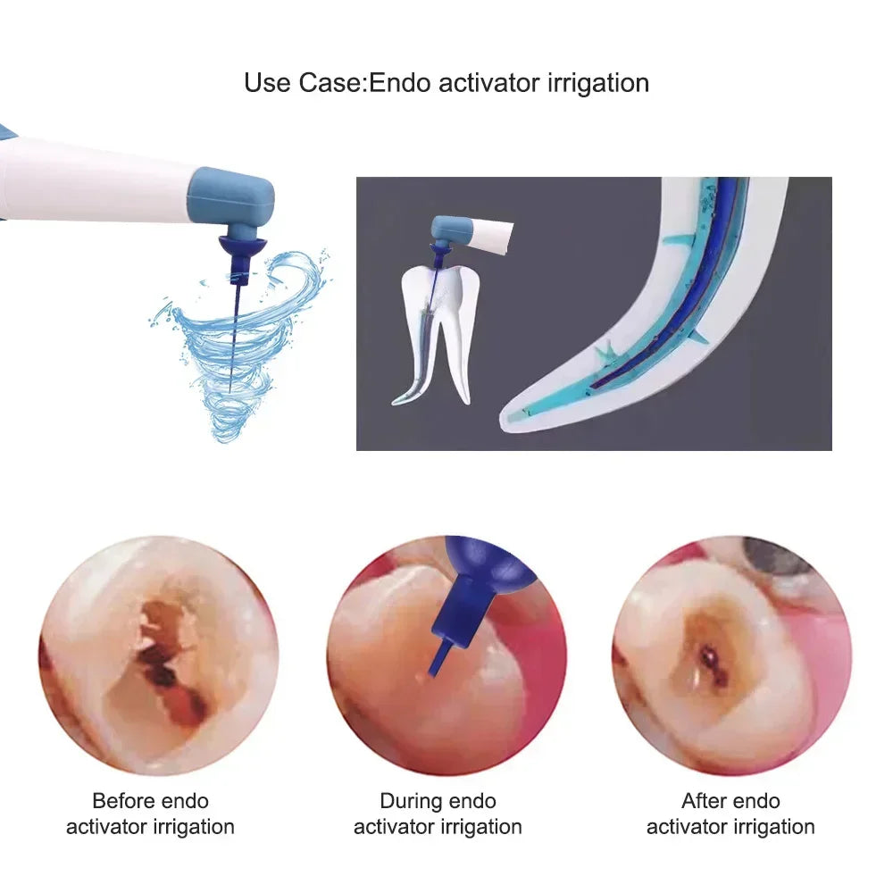 CYE068 Endo Ultrasonic Activator