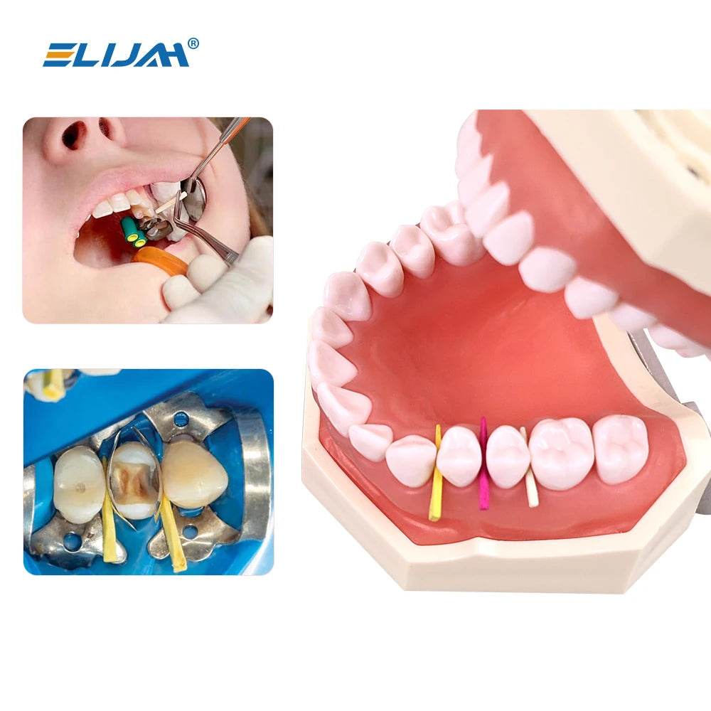 CYW707 Dental Disposable Wooden Wedges Tooth Gap Fixing Maple Wooden Wedges For Matrix System Dental Materials - Denspay Dental - Dental Wedges