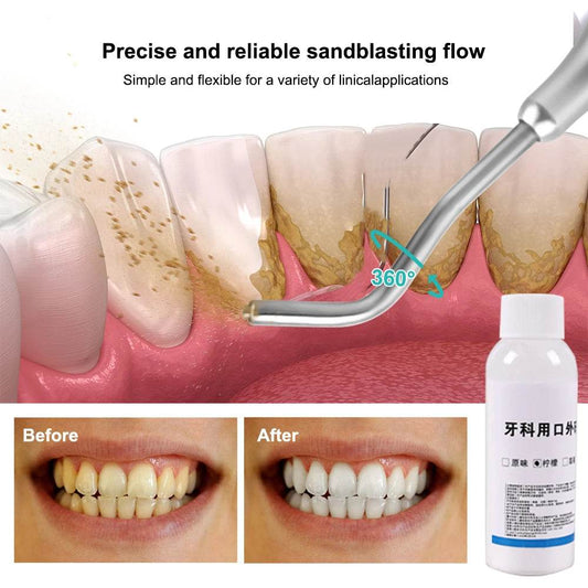 CYU217 Dental Sandblasting Powder - Denspay Dental - Air Polishing Powder