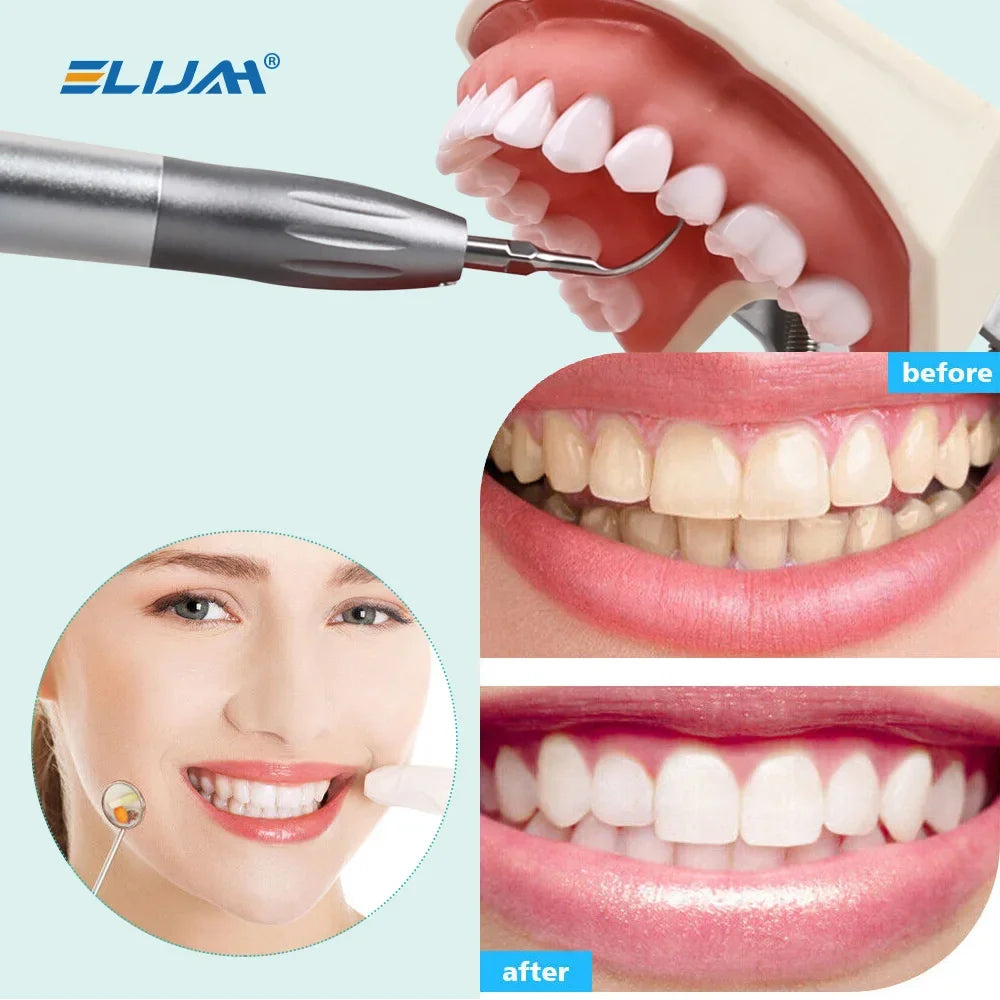 CYB090 Dental Air Scaler