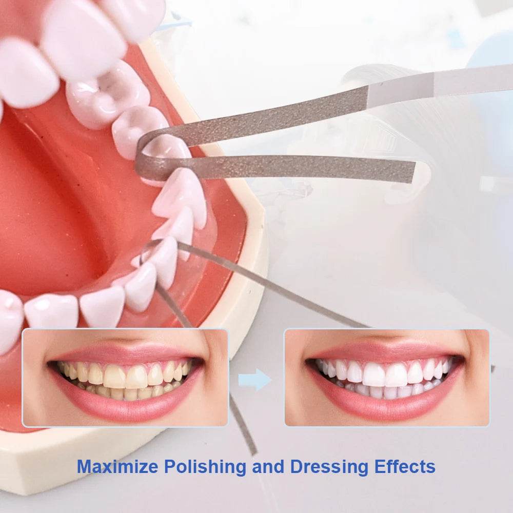 CYW865 Dental Polishing Strips - Denspay Dental - Universal Polishers & Abrasives