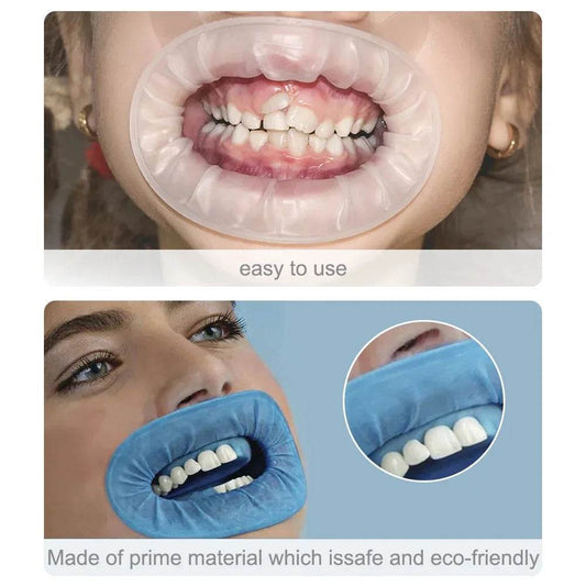 CYW036 Dental O Shape Mouth Opener - Denspay Dental - Mouth Opener