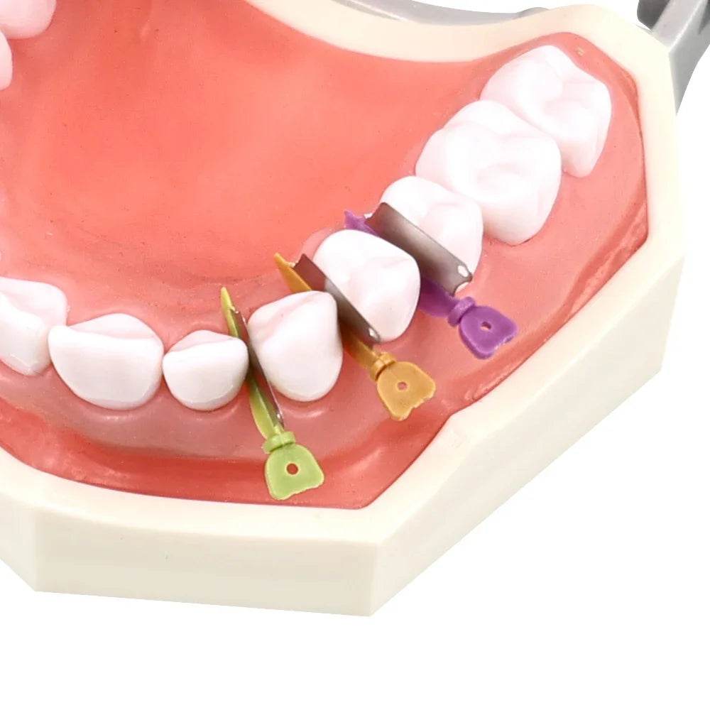 CYW459 Dental Prime Teeth Interproximal Plastic Wedge Guard - Denspay Dental - Dental Wedges