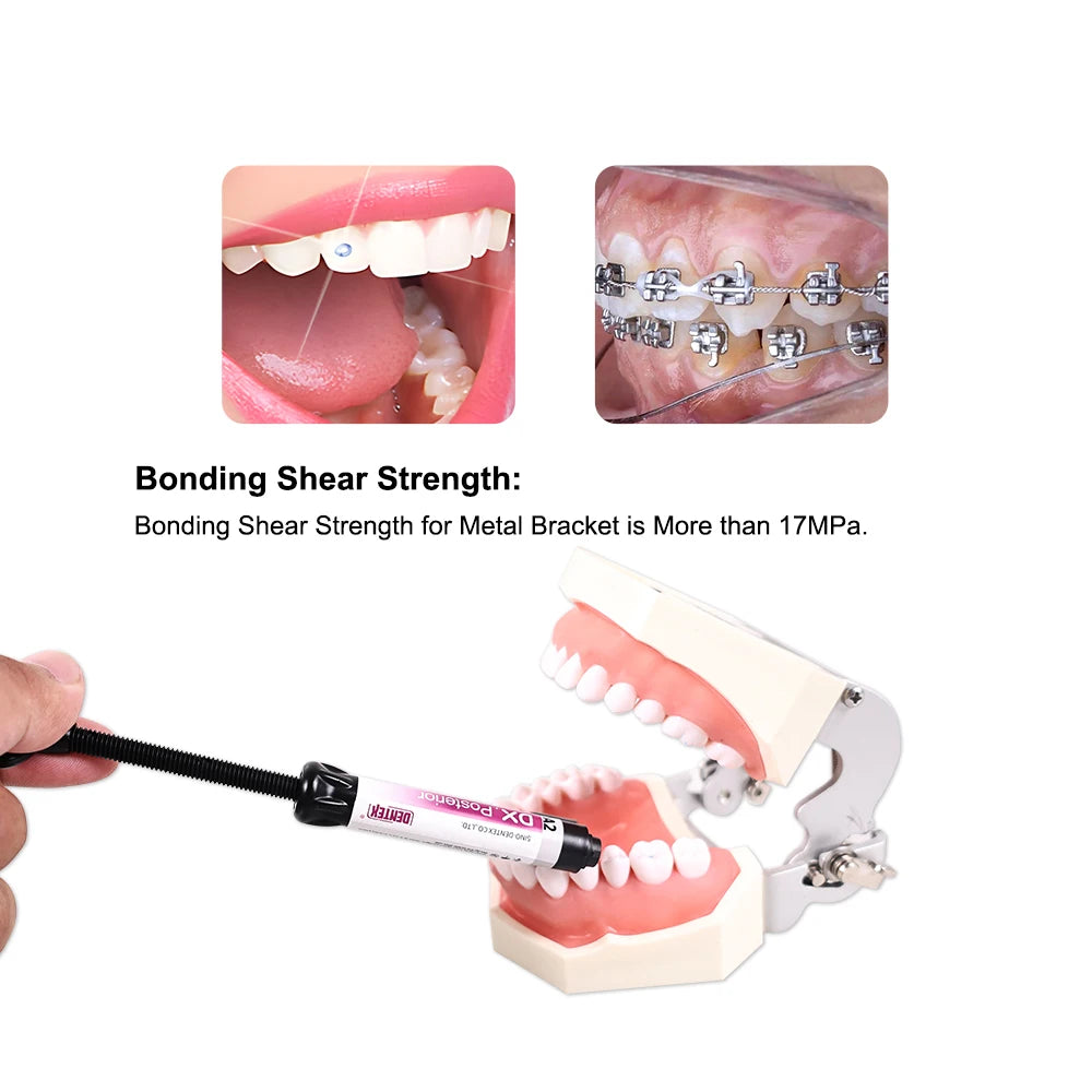 CYU115 Dentex Dental Nano Hybrid Light Cure Composite Kit
