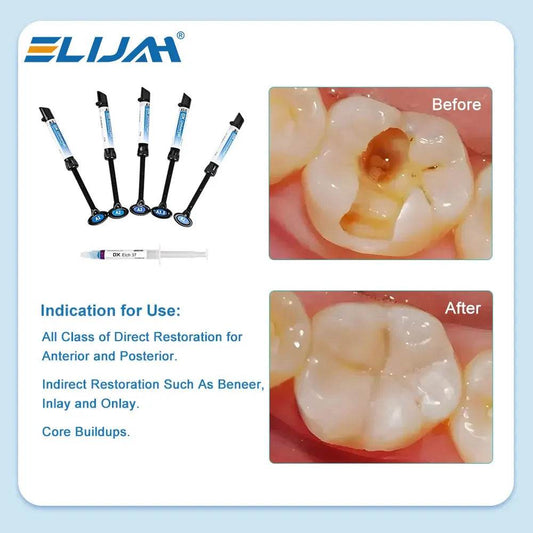 CYU196 DENTEX Dental Composite Resin Kit - Denspay Dental - Composite Resin