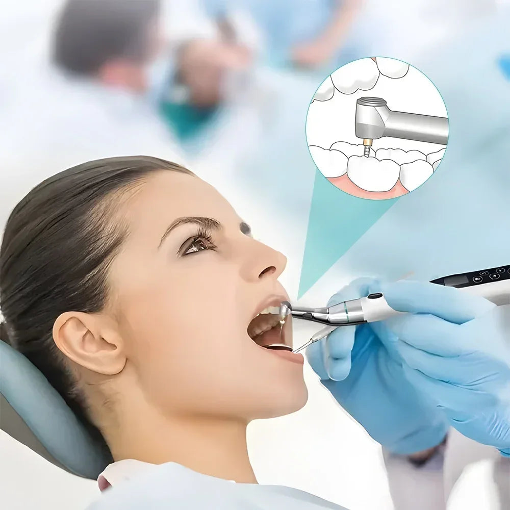 CYE027 Dental LED Endo Motor 16:1 Contra Angle