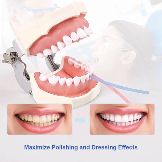 CYW864 Dental Polishing Strips - Denspay Dental - Universal Polishers & Abrasives