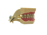 CYW464 Tooth Model