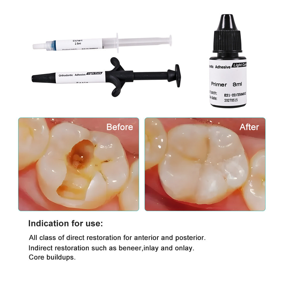 ELIJAH Dental Orthodontic Adhesive Kit Light Curing