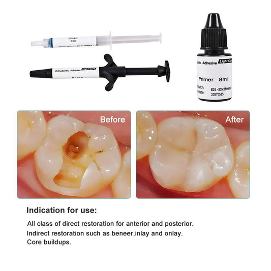 CYU210 Dental Orthodontic Adhesive Kit Light Curing - Denspay Dental - Composite Resin
