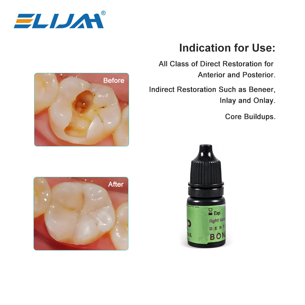 CYU013 Dental Composite Resin Kit
