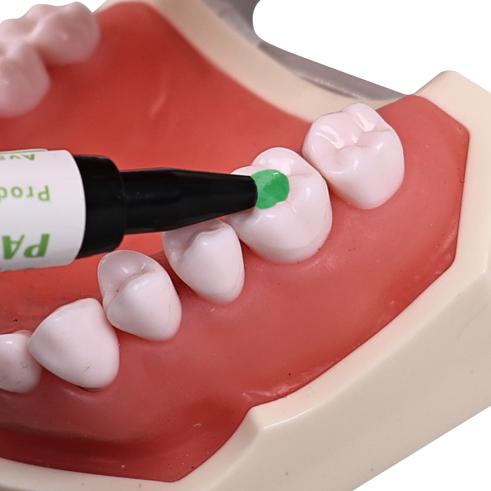 CYU159 Dental Orthodontic Adhesive Kit Green Glue