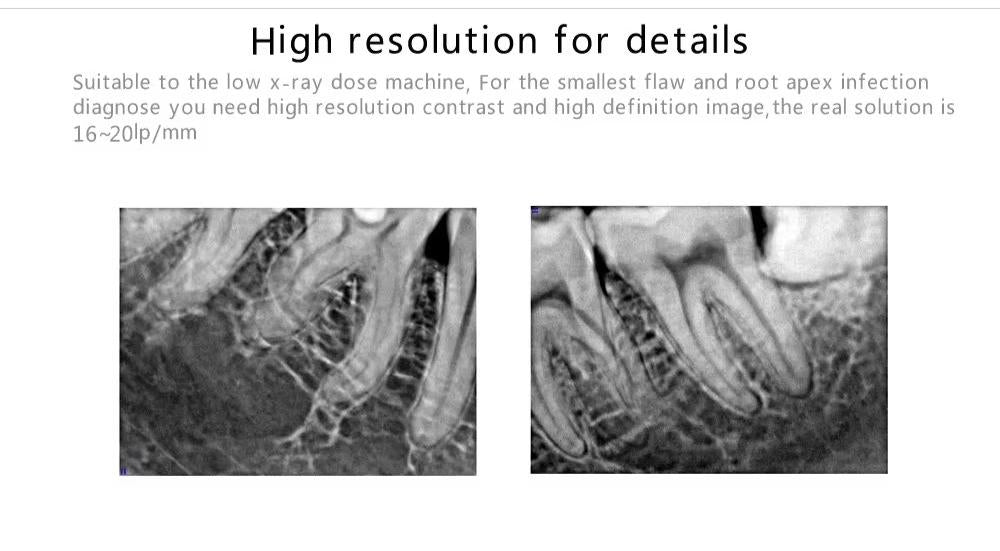 CYG017 Dental X-Ray Sensor HDR600 APS CMOS 3s Imaging - Denspay Dental - X-ray Sensor