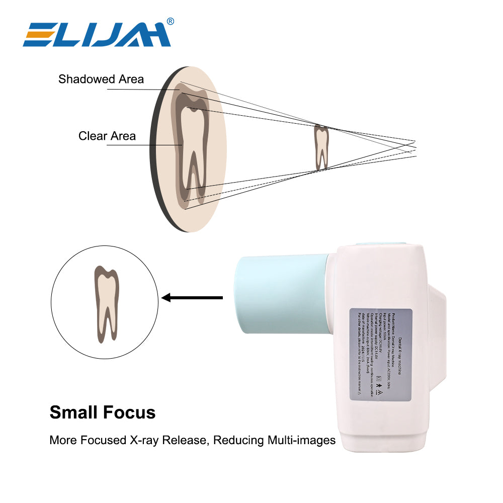 CYG079 Portable Dental X Ray Unit IPS Touch - Denspay Dental - X-ray Machine