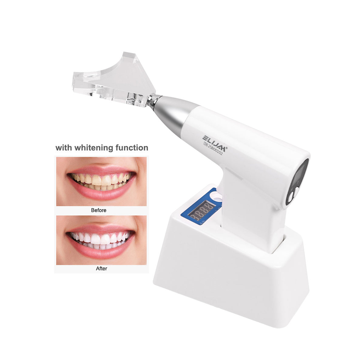 Dental clinical operation scene of 1600mw/cm² curing light for resin restoration and orthodontics