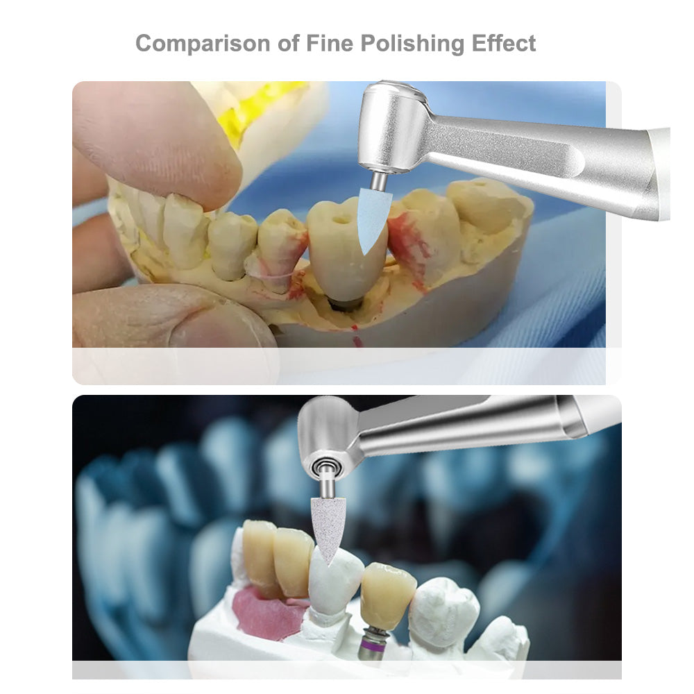 CYF231 Dental Composite Resin Polishing Kit