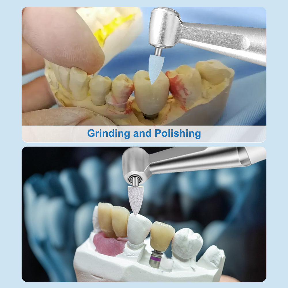 CYF231 Dental Composite Resin Polishing Kit - Denspay Dental - Resin Polishing