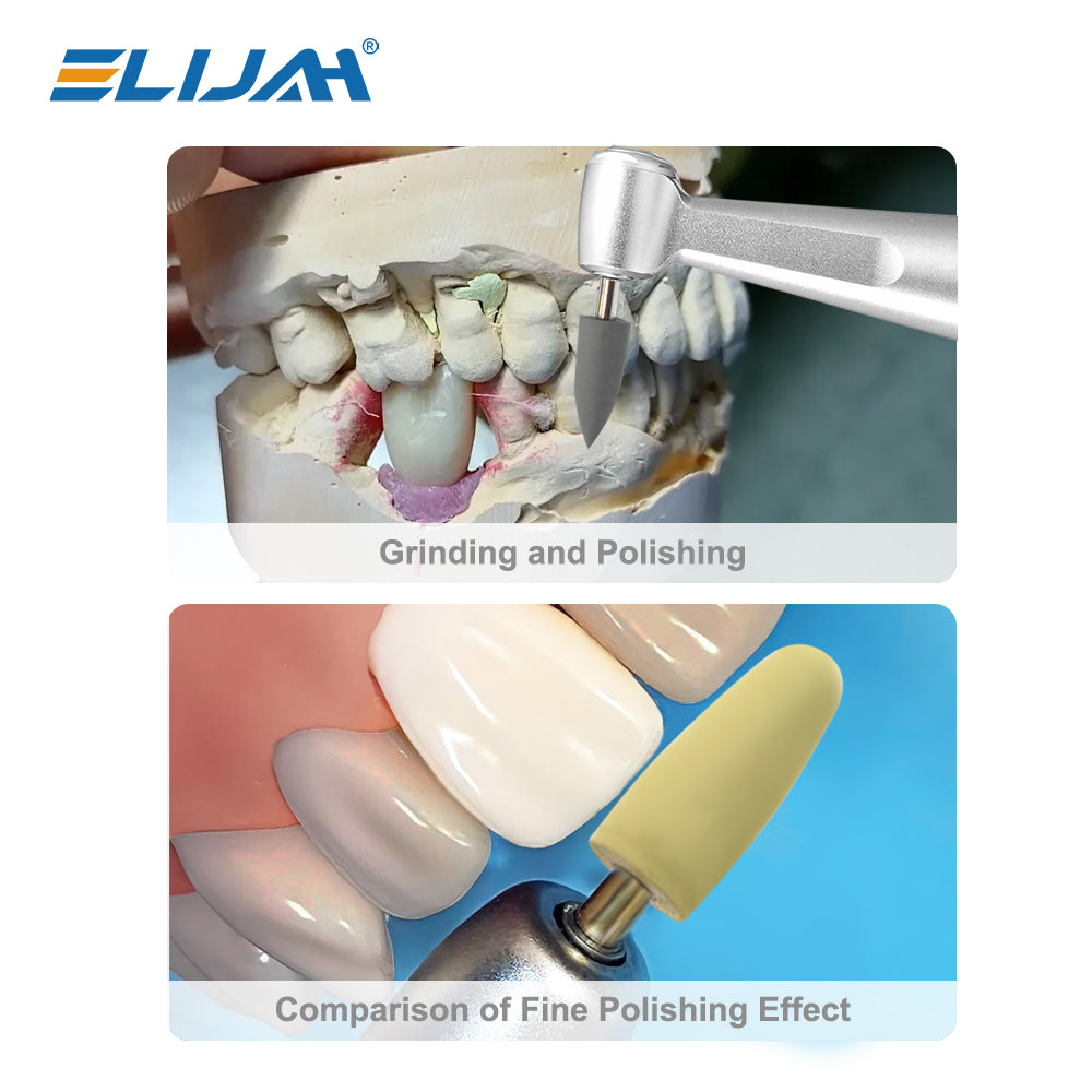 CYF230 Dental Composite Polishing Set - Denspay Dental - Resin Polishing