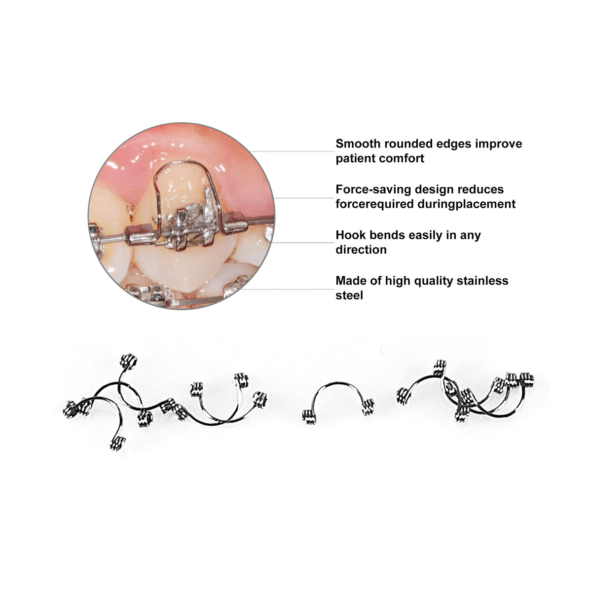 Anterior torque spring on dental model demo