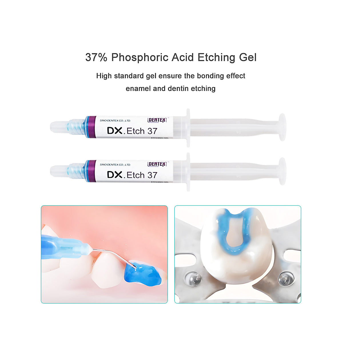 Apply etching gel on tooth enamel surface clinically