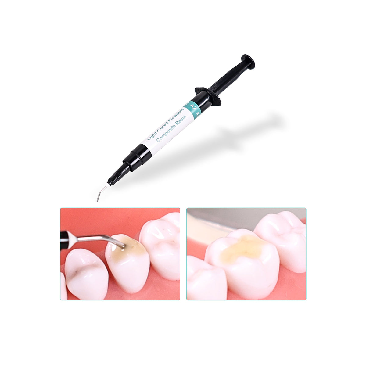 Applying Composite Resin on Cavity