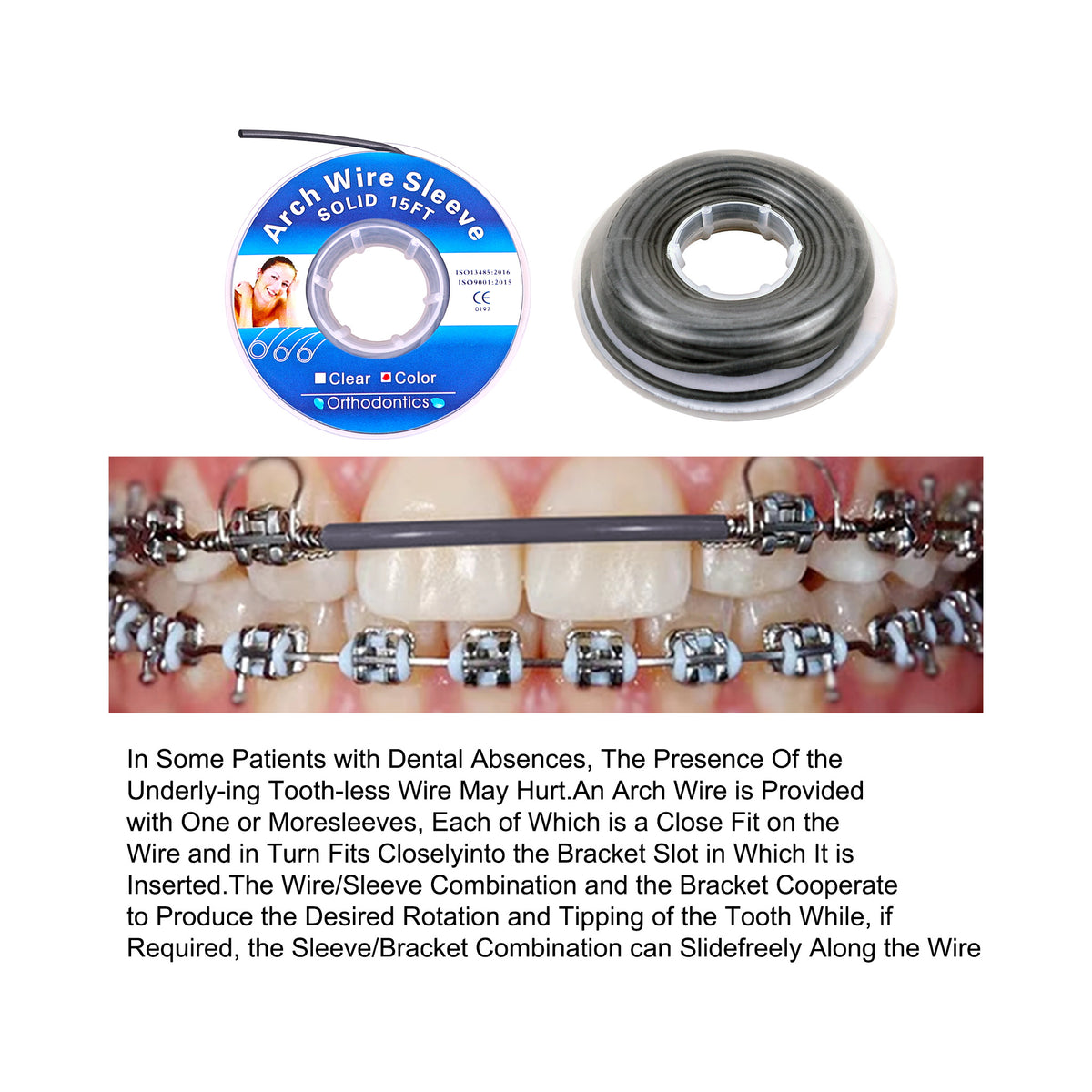 Arch wire sleeve intraoral usage demonstration picture