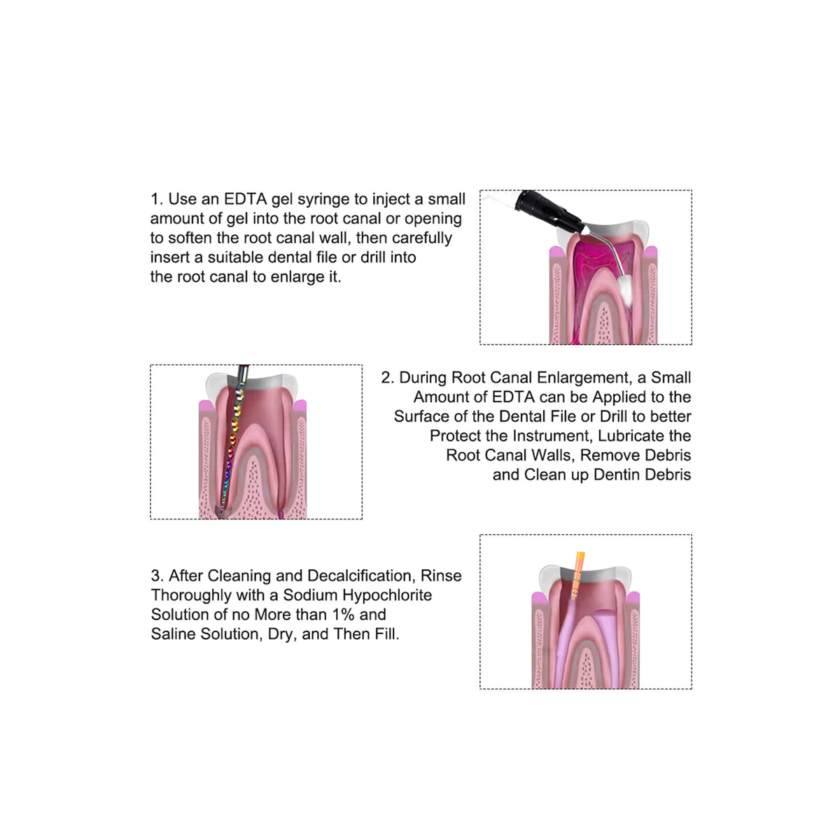 Assemble curved tip onto EDTA gel syringe