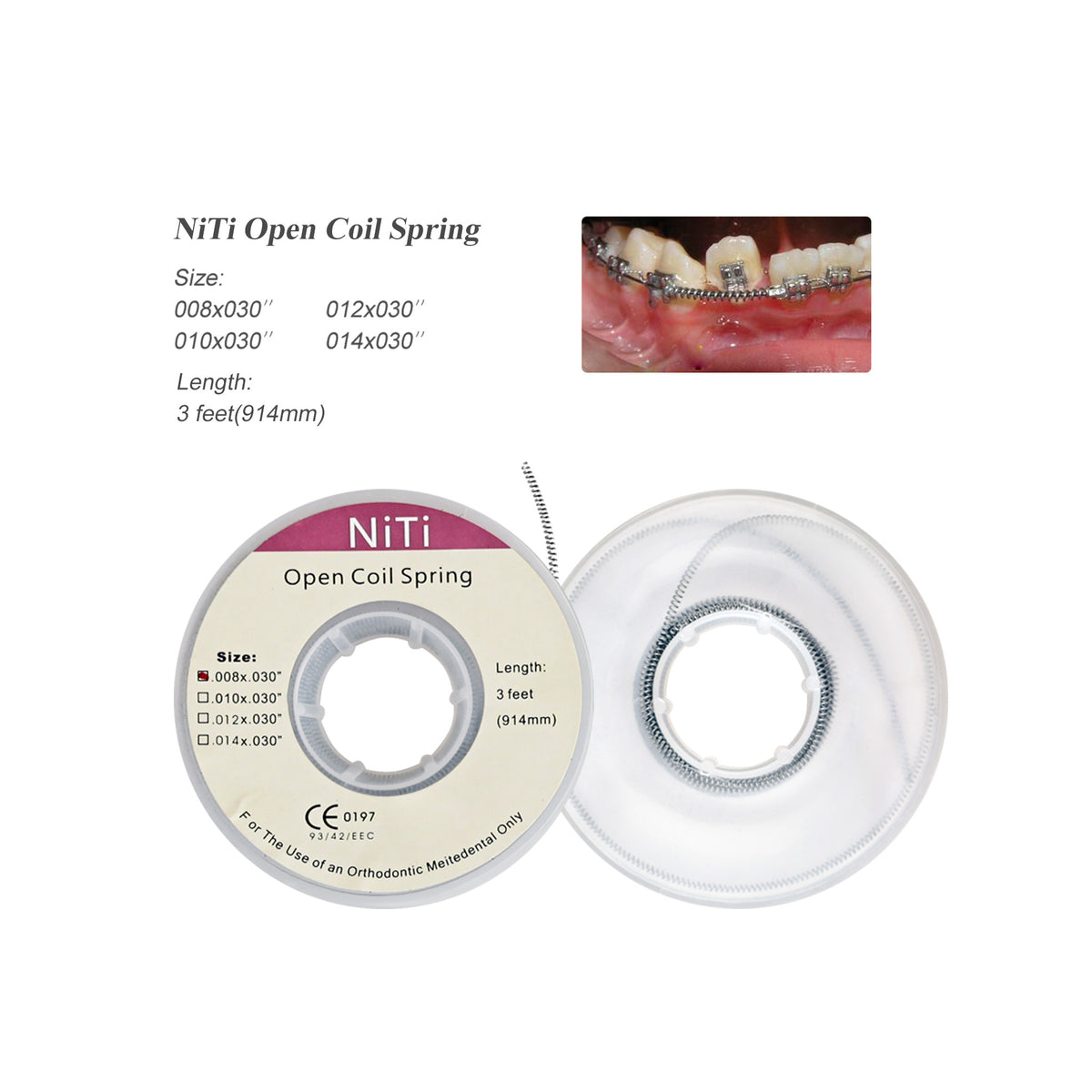Orthodontist placing open coil spring during brace treatment