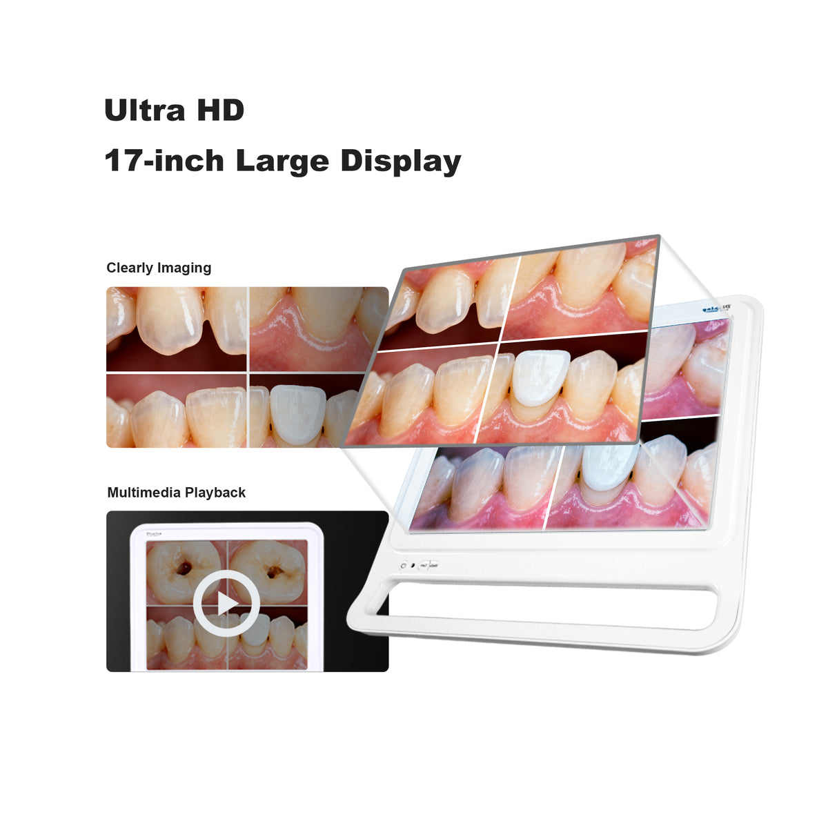 Quad split screen display of 17 inch dental intraoral camera