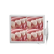 Dental Intraoral Camera With Screen 4 LED Shadowless all in one main product