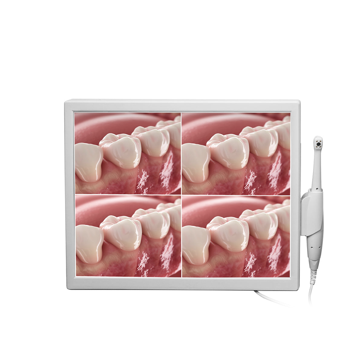 Dental Intraoral Camera With Screen 4 LED Shadowless all in one main product