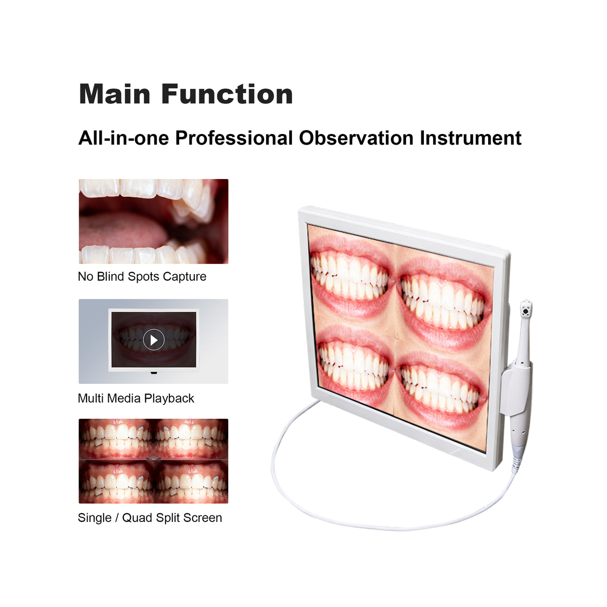 Dental treatment before-after comparison on quad screen
