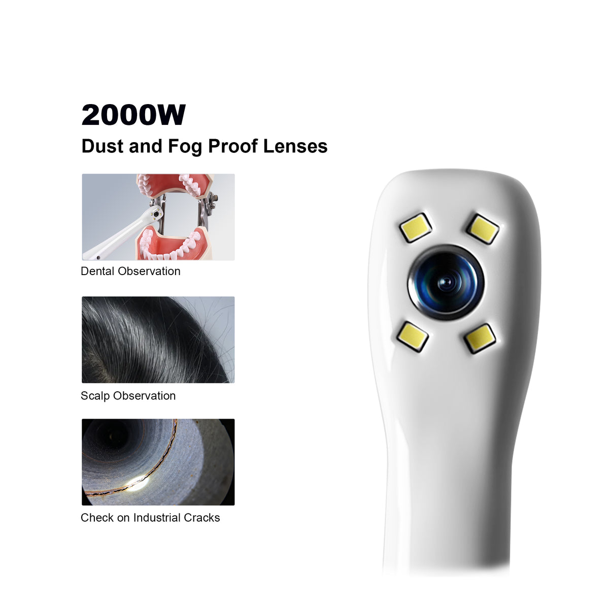 Capture and save patient oral photos on camera system