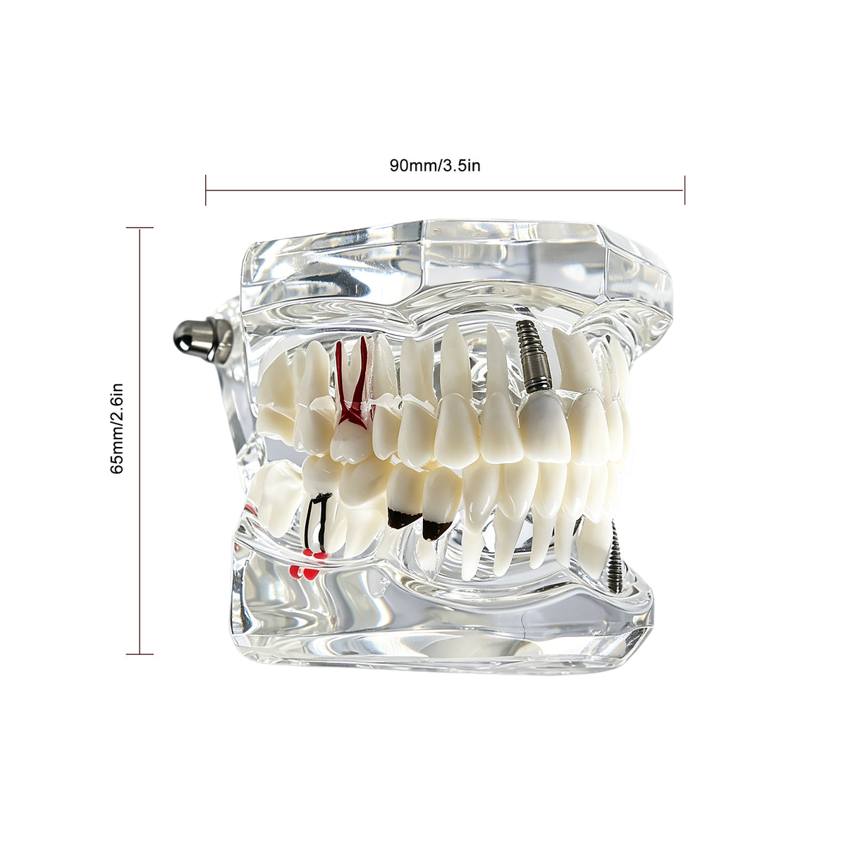 Dental pathology model packing display for shipping