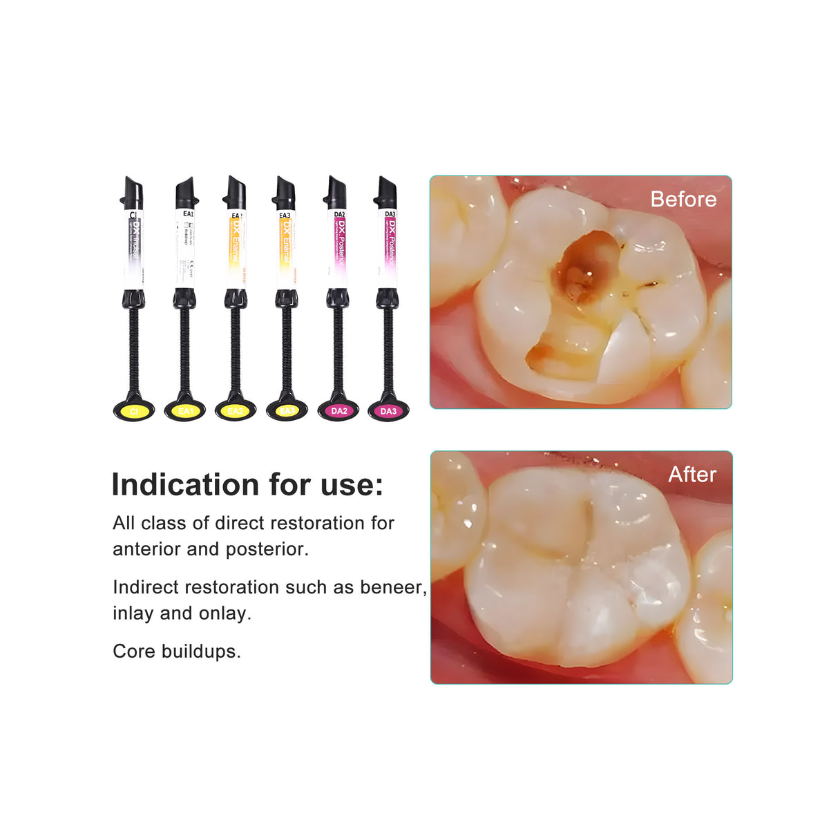 Disposable micro applicator brush tips for composite bonding