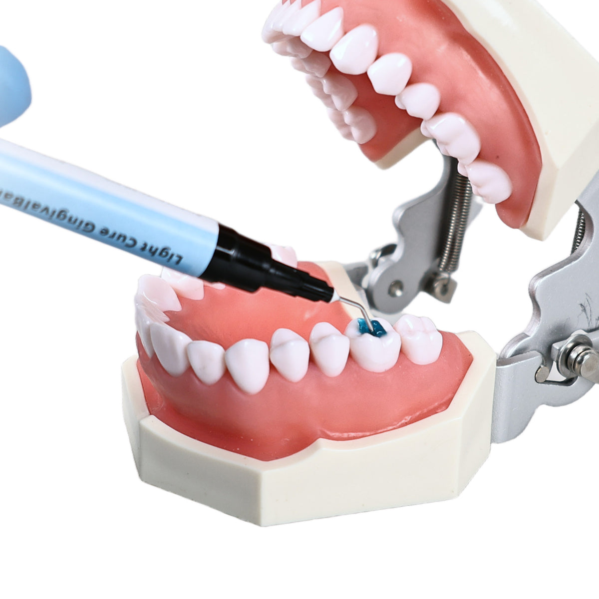 Gum Isolation Effect For Bleaching Treatment